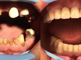 стоматология и протезирование зубов метро Динамо
